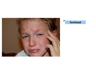 forehead 
 