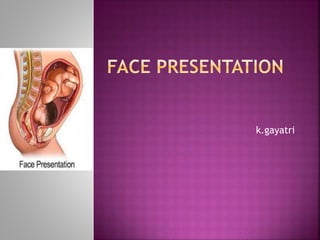 face presentation define medical