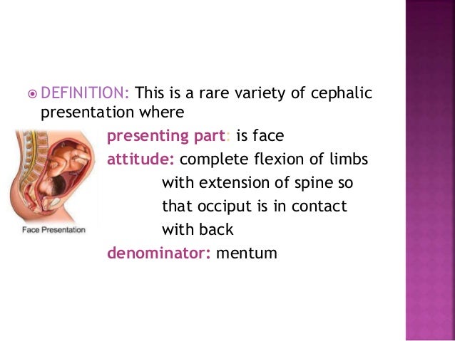 what is the presenting part in face presentation