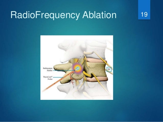 joint paracetamol pain joints Facet si and joint paracetamol pain joints Facet si and