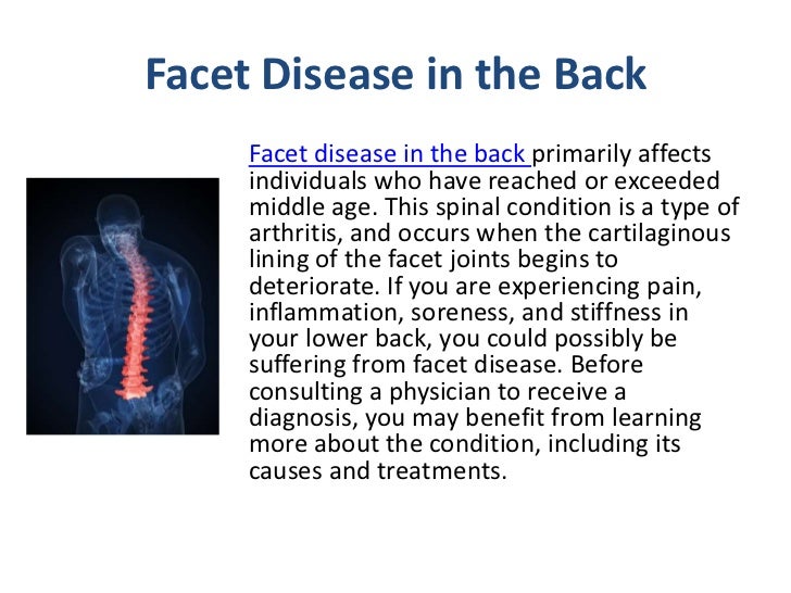 Facet Disease in the Back