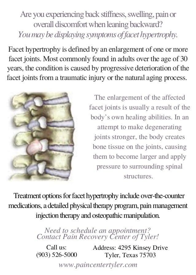 Facet Hypertrophy Pain Management Physician Tyler TX