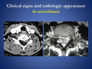 Clinical signs and radiologic appearance
in accordance
 