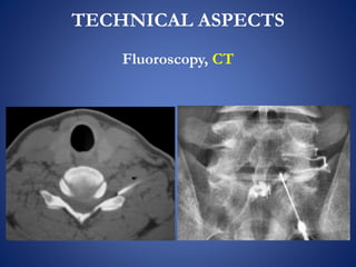 TECHNICAL ASPECTS
Fluoroscopy, CT
 