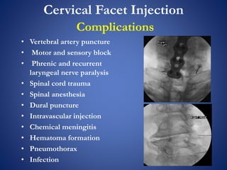 Cervical Facet Injection
Complications
• Vertebral artery puncture
• Motor and sensory block
• Phrenic and recurrent
laryngeal nerve paralysis
• Spinal cord trauma
• Spinal anesthesia
• Dural puncture
• Intravascular injection
• Chemical meningitis
• Hematoma formation
• Pneumothorax
• Infection
 