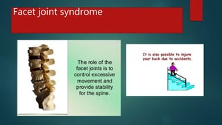 Facet joint syndrome
 