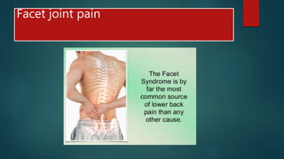 Facet joint pain
 