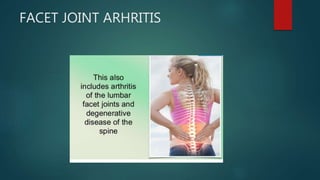 FACET JOINT ARHRITIS
 