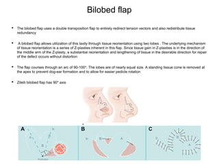 Zitelli Rotation FACIAL.FLAPS.2022.DLC.pptx