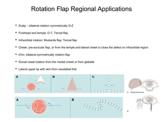 Single Rotation Flap FACIAL.FLAPS.2022.pptx