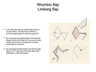 Rhombic flap
Limberg flap
• A rhombic flap may be constructed around a
circular defect. The flap and/ or defect is
trimmed appropriately to achieve a good fit.
• By oversizing the leading edge of the rhombic
design, the tip of the flap can overcome pivotal
restraint and may be transposed into place
under little to no tension.
• By increasing the flap length and takeoff angle
beyond 120*, both tips of the flap reach their
destination under less tension
 