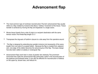 Advancement flap
• The most common type of nonlinear reconstruction.The term advancement flap usually
refers to a flap created by incisions that allow a “sliding” movement of the tissue. Tissue
transfer is achieved by moving the flap and itspedicle in a single vector.
• Moves tissue linearly from a site of origin to a recipient destination with the same
tension vector.The limited flap length is 3:1
• Transposes the dog-ears of fusiform closure to a site away from the operative wound
• The flap is designed by extending two parallel incisions (not necessarily of the same
length) from one side of a surgical defect . Because the flap is created from adjacent
skin, one edge of the defect becomes the advancing tip of the flap. This basic design
has also been called a U-plasty or rectangular flap
• Advancement flaps work best in areas of greater skin elasticity.The prominent
horizontal lines make the advancement flap particularly useful in the reconstruction of
the eyebrow and forehead areas. It can also be effective for reconstruction of defects
on the upper lip, dorsal nose, and helical rim.
 