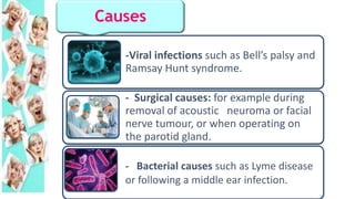 Causes
-Viral infections such as Bell’s palsy and
Ramsay Hunt syndrome.
- Surgical causes: for example during
removal of acoustic neuroma or facial
nerve tumour, or when operating on
the parotid gland.
- Bacterial causes such as Lyme disease
or following a middle ear infection.
 