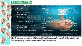 EXAMINATION
To determine the extent of the weakness in your facial muscles. The doctor can
do a variety of tests to make a Bell’s palsy diagnosis
 