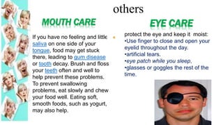 If you have no feeling and little
saliva on one side of your
tongue, food may get stuck
there, leading to gum disease
or tooth decay. Brush and floss
your teeth often and well to
help prevent these problems.
To prevent swallowing
problems, eat slowly and chew
your food well. Eating soft,
smooth foods, such as yogurt,
may also help.
MOUTH CARE EYE CARE
protect the eye and keep it moist:
•Use finger to close and open your
eyelid throughout the day.
•artificial tears.
•eye patch while you sleep,
•glasses or goggles the rest of the
time.
others
 
