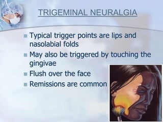 TRIGEMINAL NEURALGIA
 Typical trigger points are lips and
nasolabial folds
 May also be triggered by touching the
gingivae
 Flush over the face
 Remissions are common
 
