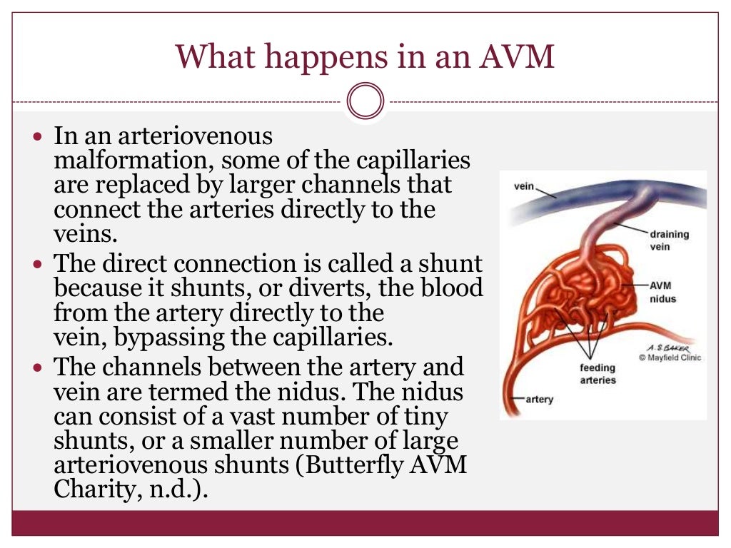 Facial arteriovenous malformations