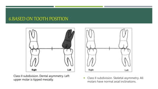 facial asymmetry ppt management in orthodontics .pptx