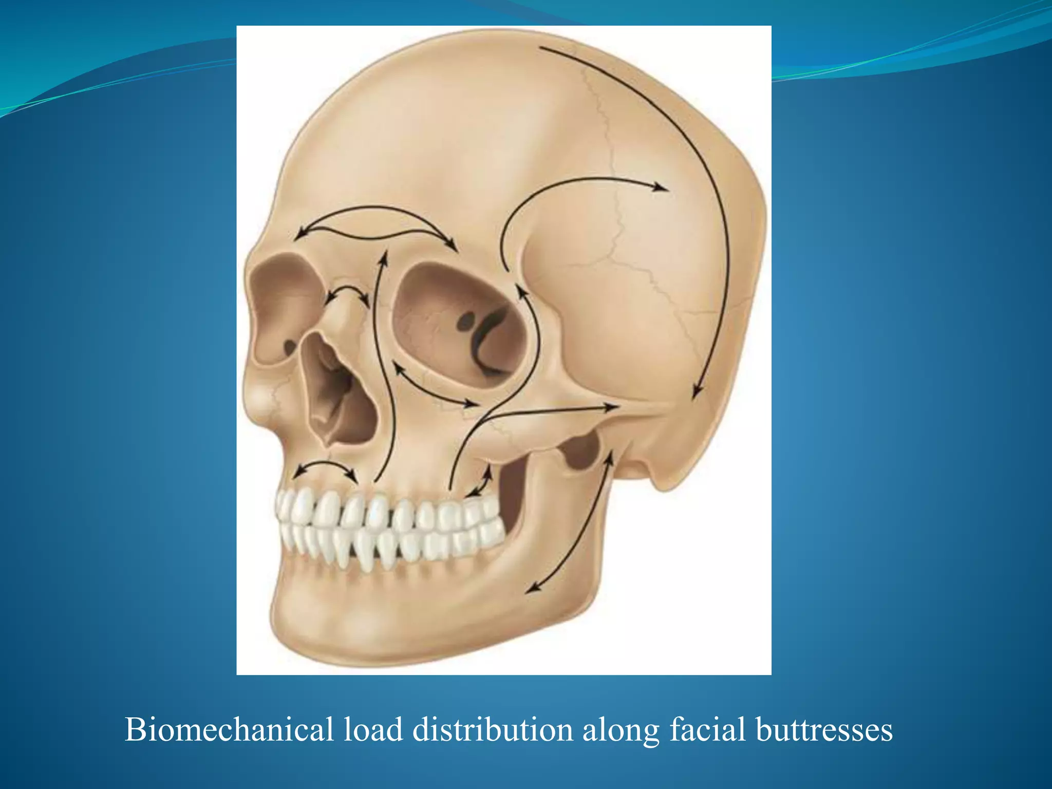 Biomechanical load distribution along facial buttresses
 