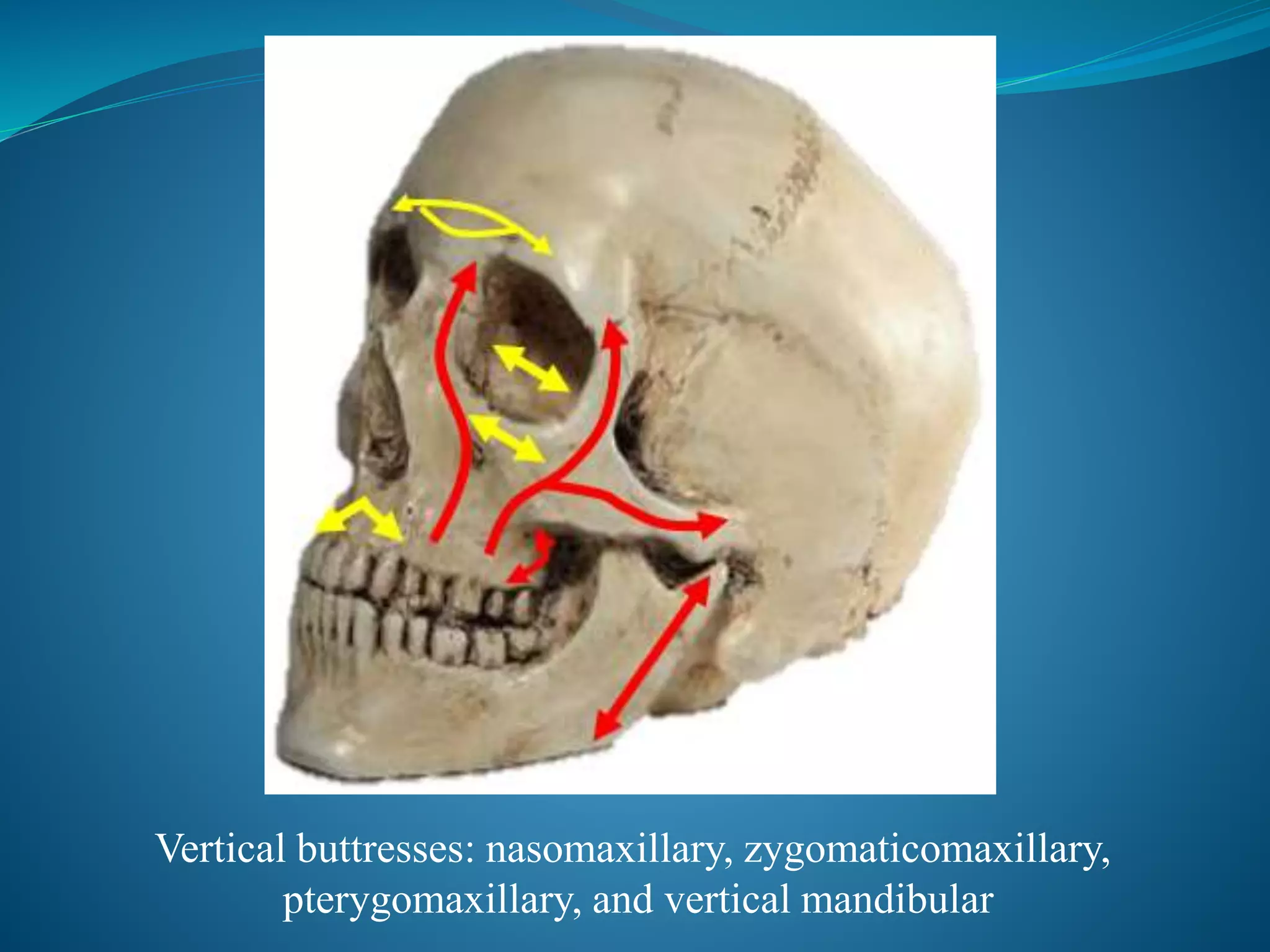 Vertical buttresses: nasomaxillary, zygomaticomaxillary,
pterygomaxillary, and vertical mandibular
 