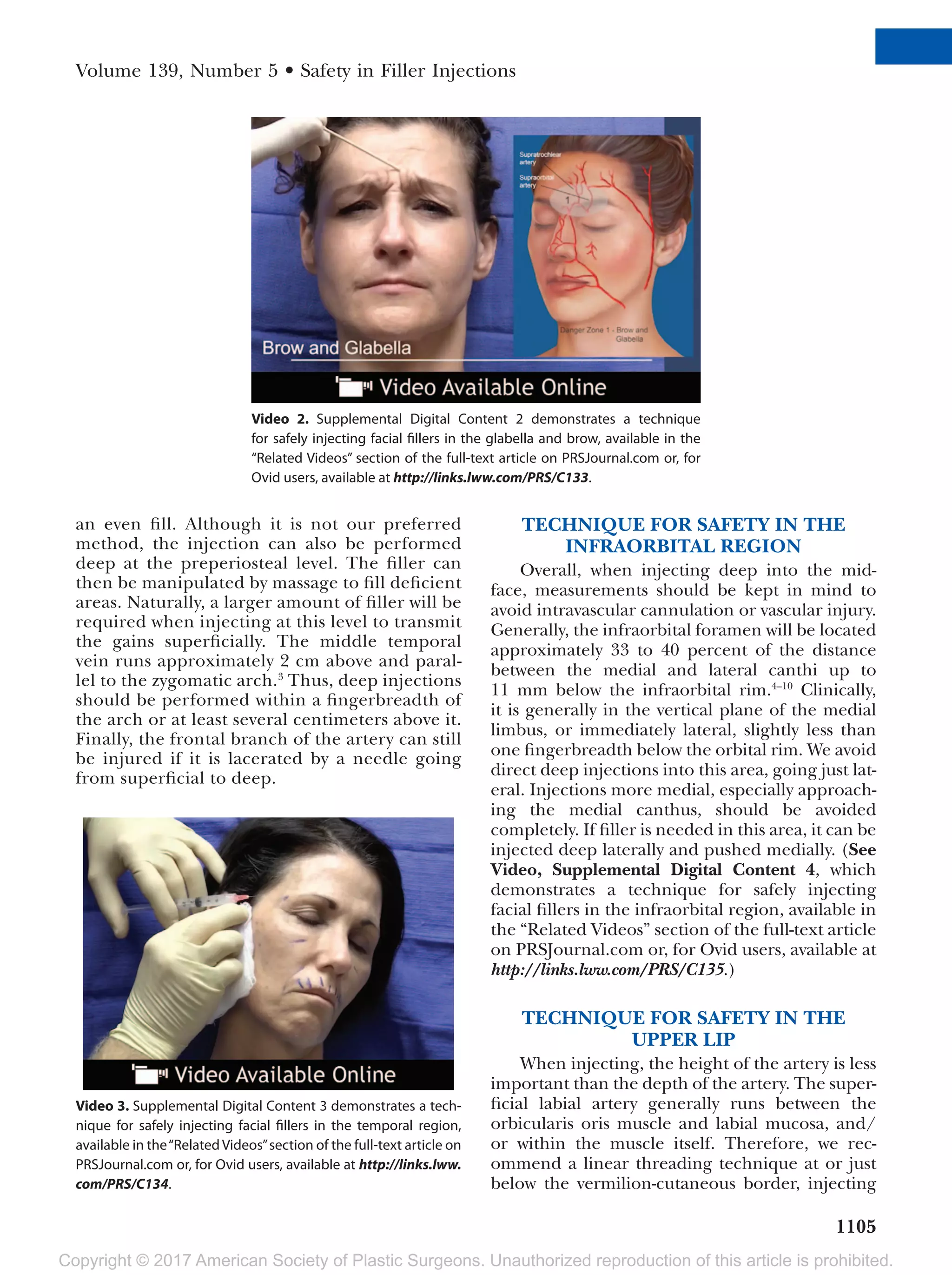 Facial danger zones techniques to maximize safety during soft tissue ...