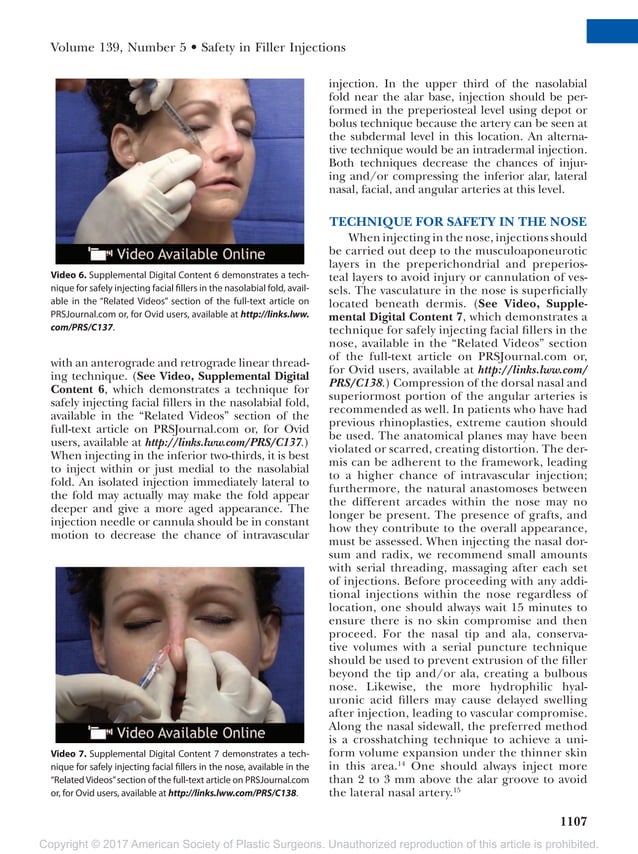 Facial danger zones techniques to maximize safety during soft tissue