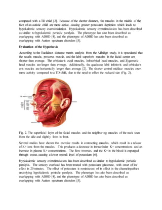 compared with a TD child [2]. Because of the shorter distance, the muscles in the middle of the
face of an autistic child are more active, causing greater potassium depletion which leads to
hypokalemic sensory overstimulation. Hypokalemic sensory overstimulation has been described
as similar to hypokalemic periodic paralysis. The phenotype has also been described as
overlapping with ADHD [4], and the phenotype of ADHD has also been described as
overlapping with Autism spectrum disorders [5].
Evaluation of the Hypothesis
According to the Euclidean distance matrix analysis from the Aldridge study, it is speculated that
the nasalis muscle, procerus muscle, and the labii superioris muscles in the facial center are
shorter than average. The orbicularis oculi muscles, Infraorbital head muscles, and Zygomatic
head muscles are longer than average. Additionally, the quadratus labii inferioris and orbicularis
oris muscles are horizontally longer than average [2]. The shorter central midface muscles exert
more activity compared to a TD child, due to the need to offset the reduced size (Fig. 2).
Fig. 2. The superficial layer of the facial muscles and the neighboring muscles of the neck seen
from the side and slightly from in front.
Several studies have shown that exercise results in contracting muscles, which result in a release
of K+ ions from the muscles. This produces a decrease in intracellular K+ concentrations and an
increase in plasma K+ concentrations. The flow reverses, and the K+ in the blood is expunged
through sweat, causing a lower overall level of potassium [6].
Hypokalemic sensory overstimulation has been described as similar to hypokalemic periodic
paralysis. The sensory overload has been treated with potassium gluconate, with onset of the
effect in 20 minutes. The effect of potassium is reminiscent of its effect in the channelopathies
underlying hypokalemic periodic paralysis. The phenotype has also been described as
overlapping with ADHD [4], and the phenotype of ADHD has also been described as
overlapping with Autism spectrum disorders [5].
 