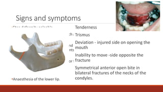 Facial fracture | PPTX