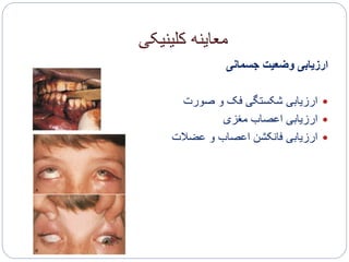 ‫کلینیکی‬ ‫معاینه‬
‫جسمانی‬ ‫وضعیت‬ ‫ارزیابی‬
‫صورت‬ ‫و‬ ‫فک‬ ‫شکستگی‬ ‫ارزیابی‬
‫مغزی‬ ‫اعصاب‬ ‫ارزیابی‬
‫عضالت‬ ‫و‬ ‫اعصاب‬ ‫فانکشن‬ ‫ارزیابی‬
 