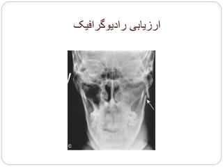 ‫رادیوگرافیک‬ ‫ارزیابی‬
 