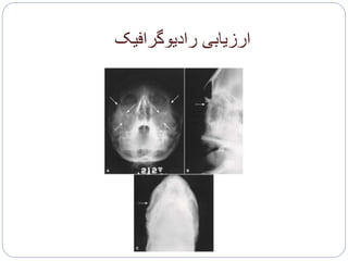 ‫رادیوگرافیک‬ ‫ارزیابی‬
 