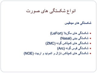 ‫صورت‬ ‫های‬ ‫شکستگی‬ ‫انواع‬
‫میدفیس‬ ‫های‬ ‫شکستگی‬
‫مگزیال‬ ‫های‬ ‫شکستگی‬(LeFort)
‫بینی‬ ‫شکستگی‬(Nasal)
‫گونه‬ ‫کمپلکس‬ ‫های‬ ‫شکستگی‬(ZMC)
‫گونه‬ ‫قوس‬ ‫شکستگی‬(Arc)
‫اربیت‬ ‫و‬ ‫اتموئید‬ ‫و‬ ‫نازال‬ ‫کمپلکس‬ ‫های‬ ‫شکستگی‬(NOE)
 