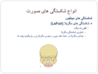 ‫صورت‬ ‫های‬ ‫شکستگی‬ ‫انواع‬
‫میدفیس‬ ‫های‬ ‫شکستگی‬
‫مگزیال‬ ‫های‬ ‫شکستگی‬(LeFort)
‫یک‬ ‫لفورت‬:
‫مگزیال‬ ‫شکستگی‬ ‫شایترین‬
‫پلی‬ ‫پتریگوئید‬ ‫و‬ ‫مگزیالری‬ ‫سینوس‬ ‫و‬ ‫بینی‬ ‫کف‬ ‫امتداد‬ ‫در‬ ‫مگزیال‬ ‫جداشن‬‫ها‬ ‫ت‬
 