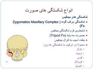‫صورت‬ ‫های‬ ‫شکستگی‬ ‫انواع‬
‫میدفیس‬ ‫های‬ ‫شکستگی‬
‫گونه‬ ‫مرکب‬ ‫شکستگی‬(Zygomatico Maxillary Complex
Fx)
‫میدفیس‬ ‫شکستگی‬ ‫فرم‬ ‫شایعترین‬
‫پایه‬ ‫سه‬ ‫بصورت‬(Tripod Fx)
‫میدفیس‬ ‫لترال‬ ‫به‬ ‫آسیب‬ ‫بعلت‬
‫زیر‬ ‫ها‬ ‫شکستگی‬ ‫با‬ ‫ترکیب‬ ‫در‬ ‫معموال‬:
‫نازال‬
‫اربیت‬
‫قوس‬
‫فرونتال‬
‫اتموئید‬
 