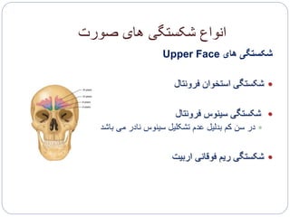 ‫صورت‬ ‫های‬ ‫شکستگی‬ ‫انواع‬
‫های‬ ‫شکستگی‬Upper Face
‫فرونتال‬ ‫استخوان‬ ‫شکستگی‬
‫فرونتال‬ ‫سینوس‬ ‫شکستگی‬
‫باشد‬ ‫می‬ ‫نادر‬ ‫سینوس‬ ‫تشکلیل‬ ‫عدم‬ ‫بدلیل‬ ‫کم‬ ‫سن‬ ‫در‬
‫اربیت‬ ‫فوقانی‬ ‫ریم‬ ‫شکستگی‬
 