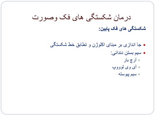 ‫وصورت‬ ‫فک‬ ‫های‬ ‫شکستگی‬ ‫درمان‬
‫پایین‬ ‫فک‬ ‫های‬ ‫شکستگی‬:
‫شکستگی‬ ‫خط‬ ‫تطابق‬ ‫و‬ ‫اکلوژن‬ ‫مبنای‬ ‫بر‬ ‫اندازی‬ ‫جا‬
‫دندانی‬ ‫بستن‬ ‫سیم‬:
‫بار‬ ‫آرچ‬
‫آ‬‫لوووپ‬ ‫وی‬ ‫ی‬
‫پیوسته‬ ‫سیم‬
 