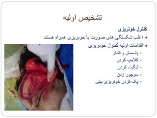 ‫اولیه‬ ‫تشخیص‬
‫خونریزی‬ ‫کنترل‬
‫هستند‬ ‫همراه‬ ‫خونریزی‬ ‫با‬ ‫صورت‬ ‫های‬ ‫شکستگی‬ ‫اغلب‬
‫خونریزی‬ ‫کنترل‬ ‫اولیه‬ ‫اقدامات‬
‫فشار‬ ‫و‬ ‫پانسمان‬
‫کردن‬ ‫کالمپ‬
‫کردن‬ ‫لیگیت‬
‫زدن‬ ‫سوچور‬
‫بینی‬ ‫خونریزی‬ ‫کردن‬ ‫پک‬
 