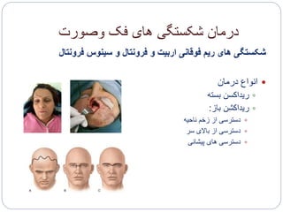 ‫وصورت‬ ‫فک‬ ‫های‬ ‫شکستگی‬ ‫درمان‬
‫فرونت‬ ‫سینوس‬ ‫و‬ ‫فرونتال‬ ‫و‬ ‫اربیت‬ ‫فوقانی‬ ‫ریم‬ ‫های‬ ‫شکستگی‬‫ال‬
‫درمان‬ ‫انواع‬
‫بسته‬ ‫ریداکسن‬
‫باز‬ ‫ریداکشن‬:
‫ناحیه‬ ‫زخم‬ ‫از‬ ‫دسترسی‬
‫سر‬ ‫باالی‬ ‫از‬ ‫دسترسی‬
‫پیشانی‬ ‫های‬ ‫دسترسی‬
 