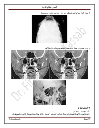 ‫الوجه‬ ‫عظام‬ ‫كسور‬
Dr. firas Kassab Page 93
ٍِ‫ٓ٘ؼ‬ ٢٘‫ٝؿ‬ ْ‫ػظ‬ ًَٔ ‫ٝؿٞى‬ ٍ‫كخ‬ ٢‫ك‬ ‫طٔظطذ‬ ٢‫حُظ‬ ٝ ‫هٔ٤ش‬ ‫ًه٘٤ش‬ ‫ٍٛٞس‬ ٝ‫أ‬
‫ٝؿٞى‬ ٍ‫كخ‬ ٢‫ك‬‫ح٧رؼخى‬ ‫ػ٬ػ٤ش‬ ‫ٓوخٍرش‬ ‫ٓغ‬ ٢‫ٓوطؼ‬ َ٣ٜٞ‫ط‬ ‫اؿَحء‬ َ٠‫٣ل‬ ‫ٗي‬
F-‫حُٔ٠خػلخص‬
-‫حُِ٘ف‬ ‫ٗيس‬ ‫رٔزذ‬ ٚٓ‫حُٜي‬
-‫ا‬ٖ٤‫حُؼ‬ ‫ٛخرش‬ٝ‫أ‬ ‫حُوَ٣زش‬ ‫ح٧ػٜخد‬ ٝ‫أ‬ ‫ح٧ٗق‬ ,ٝ ‫ح٧ٍرطش‬ ( ٚ‫حُٔل٤ط‬ ‫حُظَحً٤ذ‬ٝ ٍ‫ح٧ٝطخ‬‫حُٔل٤طش‬ ‫ح٧ٗٔـش‬ ٝ‫أ‬ ‫حُيٓٞ٣ش‬ ‫ح٧ٝػ٤ش‬. )
 