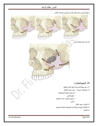 ‫الوجه‬ ‫عظام‬ ‫كسور‬
Dr. firas Kassab Page 101
ًٖ‫أٓخ‬ ‫ػ٬ع‬ ٝ‫أ‬ ٖ٤ٗ‫ٌٓخ‬ ٝ‫أ‬ ‫ٝحكي‬ ٕ‫رٌٔخ‬ ‫آخ‬ ‫حُظؼز٤ض‬ ٌٕٞ٣ ٝ
‫طؼز٤ض‬ ١‫ٗوخ‬ ‫أٍرغ‬ ٠‫كظ‬ ٝ‫أ‬
H-‫حُٔ٠خػلخص‬:
1-ْ‫حُؼظ‬ ٠ِ‫ػ‬ ‫حَُهٞس‬ ‫حُ٘ٔؾ‬ ‫طٟٞغ‬ ‫ٓٞء‬
2-: ‫ػ٤٘٤ش‬ ‫ٓ٠خػلخص‬-‫حُٔوِش‬ ‫هِق‬ ‫ِٗف‬
-‫حُٔ٠خػلش‬ ‫حَُإ٣ش‬ ٍ‫آظَٔح‬
-ٖ٤‫حُؼ‬ ٍٝ‫ؿئ‬
-‫حُلـخؽ‬ ‫طلض‬ ‫حُؼٜذ‬ ٕٞ٘‫ط‬
-٠ٔ‫ػ‬
3-‫كٌ٤ش‬ ‫ؿ٤ٞد‬ ‫اُظٜخد‬
4-٢ِ‫حُٔل‬ ‫ُِلي‬ ١ٍ‫حُٔ٘وخ‬ ‫حُ٘خطت‬ ‫ٓغ‬ ‫حُٞؿ٘ش‬ ‫اُظٜخم‬
5-ٕ‫ح٩ٗظخ‬
 