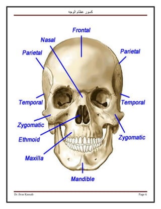 ‫الوجه‬ ‫عظام‬ ‫كسور‬
Dr. firas Kassab Page 6
 