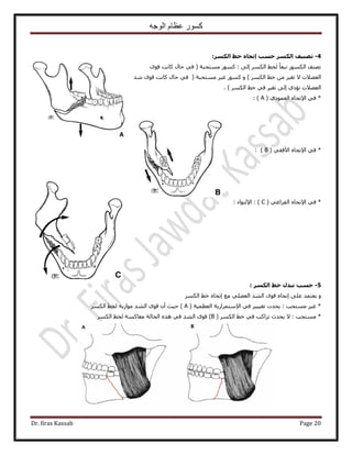 ‫الوجه‬ ‫عظام‬ ‫كسور‬
Dr. firas Kassab Page 20
4-‫إ‬ ‫حسة‬ ‫اىنسش‬ ‫ذصٍْف‬‫اىنسش‬ ‫خظ‬ ٓ‫ذجا‬:
‫ٓٔظلزش‬ ًٍٞٔ : ٠ُ‫ا‬ ٌَُٔ‫ح‬ ٢‫ُو‬ ً‫خ‬‫طزؼ‬ ٌٍُٞٔ‫ح‬ ‫طٜ٘ق‬ٟٞ‫ه‬ ‫ًخٗض‬ ٍ‫كخ‬ ٢‫ك‬ (
) ٌَُٔ‫ح‬ ٢‫ه‬ ٖٓ َ٤‫طـ‬ ٫ ‫حُؼ٠٬ص‬َٝ٤‫ؿ‬ ًٍٞٔ‫ٓٔظلزش‬‫ٗي‬ ٟٞ‫ه‬ ‫ًخٗض‬ ٍ‫كخ‬ ٢‫ك‬ (
) ٌَُٔ‫ح‬ ٢‫ه‬ ٢‫ك‬ َ٤‫طـ‬ ٠ُ‫ا‬ ١‫طئى‬ ‫حُؼ٠٬ص‬.
١‫حُؼٔٞى‬ ٙ‫ح٩طـخ‬ ٢‫ك‬ *(A):
٢‫ح٧كو‬ ٙ‫ح٩طـخ‬ ٢‫ك‬ *(B):
٢‫حُلَحؿ‬ ٙ‫ح٩طـخ‬ ٢‫ك‬ *(C): ‫ح٩ُظٞحء‬ :
5-‫حسة‬‫اىنسش‬ ‫خظ‬ ‫ذثذه‬:
ٌَُٝٔ‫ح‬ ٢‫ه‬ ٙ‫اطـخ‬ ‫ٓغ‬ ٢ِ٠‫حُؼ‬ ‫حُ٘ي‬ ٟٞ‫ه‬ ٙ‫اطـخ‬ ٠ِ‫ػ‬ ‫٣ؼظٔي‬
( ‫حُؼظٔ٤ش‬ ‫ح٩ٓظَٔحٍ٣ش‬ ٢‫ك‬ َ٤٤٤‫طـ‬ ‫٣ليص‬ : ‫ٓٔظلذ‬ َ٤‫ؿ‬ *Aٌَُٔ‫ح‬ ٢‫ُو‬ ‫ٓٞحُ٣ش‬ ‫حُ٘ي‬ ٟٞ‫ه‬ ٕ‫أ‬ ‫ك٤غ‬ )
( ٌَُٔ‫ح‬ ٢‫ه‬ ٢‫ك‬ ‫طَحًذ‬ ‫٣ليع‬ ٫ : ‫ٓٔظلذ‬ *B)ٌَُٔ‫ح‬ ٢‫ُو‬ ‫ٓؼخًٔش‬ ‫حُلخُش‬ ٌٙٛ ٢‫ك‬ ‫حُ٘ي‬ ٟٞ‫ه‬
 