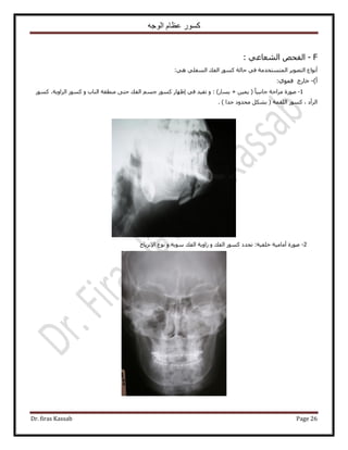 ‫الوجه‬ ‫عظام‬ ‫كسور‬
Dr. firas Kassab Page 26
F-ٚ‫حُلل‬٢‫حُ٘ؼخػ‬:
ُ‫ح‬ َ٣ٜٞ‫حُظ‬ ‫أٗٞحع‬ٔٓ‫ظٔظوي‬‫ش‬ًٔ ‫كخُش‬ ٢‫ك‬٢ِ‫حُٔل‬ ‫حُلي‬ ٍٞ٢ٛ:
‫أ‬)-‫هخٍؽ‬١ٞٔ‫ك‬:
1-)ٍ‫٣ٔخ‬ + ٖ٤ٔ٣ ( ً‫خ‬٤‫ؿخٗز‬ ‫ِٓحكش‬ ‫ٍٛٞس‬ٝ :ًٍٞٔ ٍ‫اظٜخ‬ ٢‫ك‬ ‫طل٤ي‬ٝ ‫حُ٘خد‬ ‫ٓ٘طوش‬ ٠‫كظ‬ ‫حُلي‬ ْٔ‫ؿ‬ًٍٞٔ ،‫حُِحٝ٣ش‬ ًٍٞٔ
‫حُِؤش‬ ًٍٞٔ ، ‫حَُأى‬. ) ‫ؿيح‬ ‫ٓليٝى‬ ٌَ٘‫ر‬ (
2-‫أٓخٓ٤ش‬ ‫ٍٛٞس‬:‫هِل٤ش‬ٝ ‫حُلي‬ ًٍٞٔ ‫طليى‬ٝ ‫ٓٞ٣ش‬ ‫حُلي‬ ‫ُحٝ٣ش‬٩‫ح‬ ‫ٗٞع‬‫ِٗ٣خف‬
 
