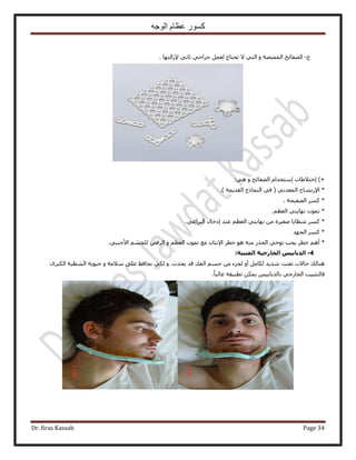 ‫الوجه‬ ‫عظام‬ ‫كسور‬
Dr. firas Kassab Page 34
‫ؽ‬-‫ُؼ‬ ‫طلظخؽ‬ ٫ ٢‫حُظ‬ ٝ ‫حُٔٔظٜش‬ ‫حُٜلخثق‬. ‫٩ُحُظٜخ‬ ٢ٗ‫ػخ‬ ٢‫ؿَحك‬ َٔ
)+‫ا‬‫هظ٬١خص‬‫ا‬ٝ ‫حُٜلخثق‬ ّ‫ٓظويح‬٢ٛ:
*٩‫ح‬٢ٗ‫حُٔؼي‬ ‫ٍط٘خف‬) ‫حُوي٣ٔش‬ ‫حُ٘ٔخًؽ‬ ٢‫ك‬ (.
*‫حُٜل٤لش‬ ًَٔ،
*ْ‫حُؼظ‬ ٢‫ٜٗخ٣ظ‬ ‫طٔٞص‬.
*٢‫حُزَحؿ‬ ٍ‫اىهخ‬ ‫ػ٘ي‬ ْ‫حُؼظ‬ ٢‫ٜٗخ٣ظ‬ ٖٓ ‫ٛـ٤َس‬ ‫ٗظخ٣خ‬ ًَٔ.
‫حُـٜي‬ ًَٔ *
*ٝ ْ‫حُؼظ‬ ‫طٔٞص‬ ‫ٓغ‬ ٕ‫ح٩ٗظخ‬ َ‫هط‬ ٞٛ ٚ٘ٓ ٌٍ‫حُل‬ ٢‫طٞه‬ ‫٣ـذ‬ َ‫هط‬ ْٛ‫أ‬٢‫ح٧ؿ٘ز‬ ْٔ‫ُِـ‬ ٞ‫حَُك‬.
4-‫اىذتاتٍس‬:‫اىَثثرح‬ ‫اىخاسجٍح‬
ٝ .‫٣ليع‬ ‫هي‬ ‫حُلي‬ ْٔ‫ؿ‬ ٖٓ ‫ُـِء‬ ٝ‫أ‬ َٓ‫ٌُخ‬ ‫ٗي٣ي‬ ‫طلظض‬ ‫كخ٫ص‬ ‫ٛ٘خُي‬ِ‫ػ‬ ‫ٗلخكع‬ ٢ٌُ٠ٓ‫٬ٓش‬‫ك٤ٞ٣ش‬ َٟٝ‫حٌُز‬ ‫حُ٘ظ٤ش‬
ً‫خ‬‫ؿخُز‬ ٚ‫ططز٤و‬ ٌٖٔ٣ ْ٤‫رخُيرخر‬ ٢‫حُوخٍؿ‬ ‫كخُظؼز٤ض‬.
 