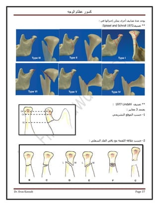 ‫الوجه‬ ‫عظام‬ ‫كسور‬
Dr. firas Kassab Page 37
‫طٜخٗ٤ق‬ ‫ػيس‬ ‫٣ٞؿي‬: ٢‫ك‬ ‫اهظِحُٜخ‬ ٌٖٔ٣ َٟ‫أه‬
‫طٜ٘٤ق‬ **Spissel and Schroll 1972:
‫طٜ٘٤ق‬ **Lindahl1977:
‫٣ؼظٔي‬3: َ٤٣‫ٓؼخ‬
1-٢‫حُظَ٘٣ل‬ ‫حُٔٞهغ‬ ‫كٔذ‬
2-: ٢ِ‫حُٔل‬ ‫حُلي‬ ٢‫رخه‬ ‫ٓغ‬ ‫حُِؤش‬ ‫ػ٬هش‬ ‫كٔذ‬
 