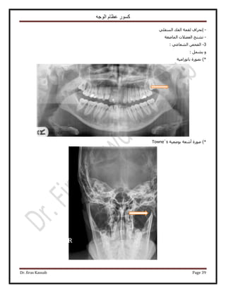 ‫الوجه‬ ‫عظام‬ ‫كسور‬
Dr. firas Kassab Page 39
-٢ِ‫حُٔل‬ ‫حُلي‬ ‫ُؤش‬ ‫اٗلَحف‬
-‫حُٔخٟـش‬ ‫حُؼ٠٬ص‬ ‫ط٘٘ؾ‬
3-: ٢‫حُ٘ؼخػ‬ ٚ‫حُلل‬
: َٔ٘٣ ٝ
‫ى‬ )*‫رخٍٗٞحٓ٤ش‬ ‫ٍٜٞس‬
)*‫رٟٞؼ٤ش‬ ‫أٗؼش‬ ‫ٍٛٞس‬Towne`s
 