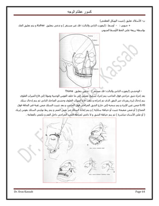 ‫الوجه‬ ‫عظام‬ ‫كسور‬
Dr. firas Kassab Page 64
‫د‬-‫ح٧ٓ٬ى‬‫طؼِ٤ن‬(‫طؼز٤ض‬ٌَ٤ُٜ‫ح‬٢ٔ‫حُؼظ‬)
+: ٢ٜ‫ؿز‬-: ٢ٓٝ‫أ‬(٤ُ‫لٍٞص‬٢ٗ‫حُؼخ‬‫ٝحُؼخُغ؛‬‫كي‬َ٤‫ؿ‬َ‫ٓٔظو‬)‫رظؼِ٤ن‬ ٠‫طيػ‬ ٝKufner‫حُلي‬ ‫طؼِ٤ن‬ ْ‫٣ظ‬ ٝ
٢ٜ‫حُـز‬ ٢ٓٝ٧‫ح‬ ٢‫حُو‬ ٠ِ‫ػ‬ ‫ٍُ٣ؼش‬ ‫رٞحٓطش‬
-٢٘‫حُٞك‬(٤ُ‫لٍٞص‬٢ٗ‫حُؼخ‬‫ٝحُؼخُغ؛‬‫كي‬َ‫ٓٔظو‬)‫رظؼِ٤ن‬ ٠‫طيػ‬ :Thoma
١ِٞ‫حُؼ‬ ‫حُٔ٤ِحد‬ ‫هخع‬ ٠ُ‫ا‬ ٫ٞٛٝ ‫حُٞؿ٘٤ش‬ ّٞ‫حُو‬ ‫هِق‬ ‫ٓخ‬ ٠ُ‫ا‬ ٢ِ٠‫ػ‬ ‫طِٔ٤ن‬ ‫اؿَحء‬ ْ‫٣ظ‬ ‫حُلخؿذ‬ ‫كٞم‬ ٢‫ؿَحك‬ ‫ٗن‬ ‫اؿَحء‬ ‫رؼي‬
ٕ‫ٍ٣لَىح‬ ‫ارَس‬ ٍ‫اىهخ‬ ْ‫٣ظ‬‫ِٓي‬ ٍ‫اىهخ‬ ْ‫٣ظ‬ ْ‫ػ‬ ٢ٗ‫حُؼخ‬ ‫حُ٠خكي‬ ٢٘‫ٝك‬ ١ِٞ‫حُؼ‬ ‫حُٔ٤ِحد‬ ‫هخع‬ ‫ٗؼوذ‬ ٝ ٙ‫اؿَحء‬ ْ‫ط‬ ١ٌُ‫ح‬ ‫حُ٘لن‬ َ‫ػز‬
0،45‫كٞم‬ ‫حُلخكش‬ ٢‫ك‬ ‫ػوزش‬ ٖٟٔ ‫حُِٔي‬ ‫طؼز٤ض‬ ‫رؼي‬ ٝ ‫حُلخؿذ‬ ‫كٞم‬ ٢‫حُـَحك‬ ‫حُ٘ن‬ ‫هخٍؽ‬ ٠ُ‫ا‬ ٚ‫ٓلز‬ ْ‫٣ظ‬ ٝ ‫ح٩رَس‬ ٖ٤‫ػ‬ ٖٟٔ
‫حُِٔي‬ ‫اػخىس‬ ْ‫٣ظ‬ ٝ ) ‫ٌِٓ٤ش‬ ‫ه٤خ١ش‬ ٝ‫أ‬ ‫طؼز٤ض‬ ‫ٛل٤لش‬ ٖٟٔ ٝ‫أ‬ ( ‫حُلـخؽ‬‫ا٣َ٣ي‬ ّٞ‫رو‬ ‫حُِٔي‬ ٢‫ٜٗخ٣ظ‬ ٢‫ٍر‬ ْ‫٣ظ‬ ٝ َُٔٔ‫ح‬ ْ‫ٗل‬ َ‫ػز‬
. ‫رخُؼوخٓش‬ ٢‫ٌٗظل‬ ٝ ْ‫حُل‬ َ‫ىحه‬ ٢‫حُـَحك‬ ‫حُؼوذ‬ ‫ُو٤خ١ش‬ ٢‫ىحػ‬ ٫ ٝ ‫حُ٘ن‬ ‫ه٤خ١ش‬ ْ‫٣ظ‬ ْ‫ػ‬ ) ‫ٓزخَٗس‬ ٕ‫ح٧ٓ٘خ‬ ٠ِ‫ػ‬ ٝ‫أ‬ (
 