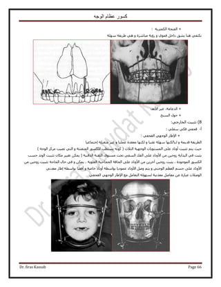 ‫الوجه‬ ‫عظام‬ ‫كسور‬
Dr. firas Kassab Page 66
+‫حٌُٔؼَ٣ش‬ ‫حُلظلش‬:
‫ِٜٓش‬ ‫١َ٣وش‬ ٢ٛ ٝ ‫ٓزخَٗس‬ ‫ٍإ٣ش‬ ٝ ١ٞٔ‫ك‬ َ‫ىحه‬ ‫ر٘ن‬ ‫ٛ٘خ‬ ٢‫ٌٗظل‬
+،‫حُيػخٓش‬َ‫ػز‬‫ح٧ٗق‬
+ٍٞ‫ك‬‫حُٔ٘ن‬
B)‫طؼز٤ض‬:٢‫حُوخٍؿ‬
‫أ‬-: ٢ِ‫ٓل‬ ٢ٌ‫ك‬ ٢‫هلل‬
٢‫حُولل‬ ٢ٜ‫حُٞؿ‬ ٍ‫ح٩١خ‬ +:
‫حُطَ٣وش‬ٍ ٝ ‫هي٣ٔش‬‫ٌُٜ٘خ‬‫اؿظٔخػ٤خ‬ ‫ٓظوزِش‬ َ٤‫ؿ‬ ٝ ‫ػِٔ٤خ‬ ‫ٓؼويس‬ ‫ٌُٜ٘خ‬ ٝ ‫طو٘٤خ‬ ‫ِٜٓش‬
‫أٝطخى‬ ‫طؼز٤ض‬ ْ‫٣ظ‬ ‫ك٤غ‬) ٚ‫حُٞؿ‬ ًَِٓ ‫طٜ٤ذ‬ ٢‫حُظ‬ ٝ ‫حُٔظلظظش‬ ٌٍُِٞٔ ‫٣ٔظطذ‬ ًٚٗٞ ( ‫حُؼ٬ع‬ ‫حُٞؿٜ٤ش‬ ‫حُٔٔظٞ٣خص‬ ٠ِ‫ػ‬
‫كٔذ‬ ‫حُٞطي‬ ‫طؼز٤ض‬ ٕ‫ٌٓخ‬ َ٤٤‫طـ‬ ٌٖٔ٣ ( ‫حٌُه٘٤ش‬ ‫حُؼوزش‬ ٟٞ‫ٓٔظ‬ ‫طلض‬ ٢‫حُٔل‬ ‫حُلي‬ ٠ِ‫ػ‬ ‫ح٧ٝطخى‬ ٖٓ ٖ٤‫ُٝؿ‬ ‫حُزيح٣ش‬ ٢‫ك‬ ‫٣ؼزض‬
٤‫حُلـخؿ‬ ‫حُلخكش‬ ٠ِ‫ػ‬ ‫ح٧ٝطخى‬ ٖٓ ٖ٣َ‫آه‬ ٖ٤‫ُٝؿ‬ ‫٣ؼزض‬ ، ‫حُٔٞؿٞىس‬ ٌٍُٞٔ‫ح‬ٖٓ ٖ٤‫ُٝؿ‬ ‫طؼز٤ض‬ ‫حُلخؿش‬ ٍ‫كخ‬ ٢‫ك‬ ٝ ٌٖٔ٣ ، ‫حُؼِٞ٣ش‬ ‫ش‬
٢ٗ‫ٓؼي‬ ٍ‫ا١خ‬ ‫رٞحٓطش‬ ‫أكو٤خ‬ ٝ ‫هخٛش‬ ‫أٝطخى‬ ‫رٞحٓطش‬ ‫ػٔٞى٣خ‬ ‫ح٧ٝطخى‬ َٛٝ ْ‫٣ظ‬ ٝ ٢٘‫حُٞؿ‬ ْ‫حُؼظ‬ ْٔ‫ؿ‬ ٠ِ‫ػ‬ ‫ح٧ٝطخى‬
٢‫حُولل‬ ٢ٜ‫حُٞؿ‬ ٍ‫ح٩١خ‬ ‫ٓغ‬ َٓ‫حُظؼخ‬ ‫ُُٜٔٞش‬ ‫ٓؼيٗ٤ش‬ َٛ‫ٓلخ‬ ٖ‫ػ‬ ‫ػزخٍس‬ ‫حُٞٛ٬ص‬
 