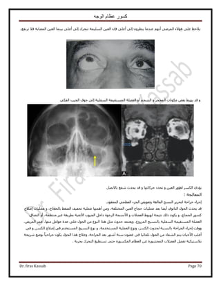 ‫الوجه‬ ‫عظام‬ ‫كسور‬
Dr. firas Kassab Page 70
‫٣٬كع‬٠ِ‫ػ‬‫ٛئ٫ء‬٠َُٟٔ‫ح‬ْٜٗ‫أ‬‫ػ٘يٓخ‬َٕٝ‫٣٘ظ‬٠ُ‫ا‬٠ِ‫أػ‬ٕ‫كب‬ٖ٤‫حُؼ‬‫حُِٔ٤ٔش‬‫طظلَى‬٠ُ‫ا‬٠ِ‫أػ‬‫ر٤٘ٔخ‬ٖ٤‫حُؼ‬‫حُٜٔخرش‬٬‫ك‬،‫طَطلغ‬
ٝ‫هي‬٢‫٣ٜز‬ٞ‫رؼ‬‫ٌٓٞٗخص‬َ‫حُٔلـ‬ْٝ‫حُ٘ل‬ٝ‫أ‬‫حُؼ٠ِش‬‫حُٔٔظو٤ٔش‬‫حُٔلِ٤ش‬٠ُ‫ا‬‫ؿٞف‬‫حُـ٤ذ‬٢ٌ‫حُل‬
١‫٣ئى‬ٌَُٔ‫ح‬ٍٝ‫ُـئ‬ٖ٤‫حُؼ‬ٝ‫طليى‬‫كًَخطٜخ‬ٝ‫هي‬‫٣ليع‬‫ٗلغ‬ٍ‫رخ٫رٜخ‬.
‫حُٔؼخُـش‬:
‫اؿَحء‬‫ؿَحكش‬َ٣َ‫ُظل‬‫حُ٘ٔؾ‬‫حُؼخُوش‬ٞ٣ٞ‫ٝطؼ‬‫حُـِء‬٢ٔ‫حُؼظ‬‫حُٔلوٞى‬.
‫هي‬‫٣ليع‬ٍٞ‫حُل‬١ٞٗ‫حُؼخ‬‫أ٣٠خ‬‫رؼي‬‫ػِٔ٤خص‬‫كـخؽ‬ٖ٤‫حُؼ‬،‫حُٔوظِلش‬ٖٓٝ‫أٜٛٔخ‬‫ػِٔ٤ش‬‫طول٤ق‬٢‫حُ٠ـ‬،‫رخُلـخؽ‬ٝ‫ػِٔ٤خص‬‫اٛ٬ف‬
ًٍٞٔ،‫حُلـخؽ‬ٌٕٝٞ٣‫ًُي‬‫ٗظ٤ـش‬١ٞ‫ُٜز‬‫حُؼ٠٬ص‬ٝ‫ح٧ٗٔـش‬‫حَُهٞس‬َ‫ىحه‬‫حُـ٤ٞد‬‫ح٧ٗل٤ش‬‫رطَ٣وش‬َ٤‫ؿ‬،‫ٓ٘ظظٔش‬ٝ‫أ‬‫حُظٜخم‬
‫حُؼ٠ِش‬‫حُٔٔظو٤ٔش‬‫حُٔلِ٤ش‬‫رخُ٘ٔ٤ؾ‬،‫حٍُِٔٝع‬‫ٝ٣ؼظٔي‬‫كيٝع‬َ‫ٓؼ‬‫ٌٛح‬‫حُ٘ٞع‬ٍٖٓٞ‫حُل‬٠ِ‫ػ‬‫ػيس‬َٓ‫ػٞح‬،‫ٜٓ٘خ‬َٔ‫ػ‬،ٞ٣َُٔ‫ح‬
‫ٝٝهض‬‫اؿَحء‬‫حُـَحكش‬‫رخُ٘ٔزش‬‫ُليٝع‬،ٌَُٔ‫ح‬‫ٝٗٞع‬‫حُؼِٔ٤ش‬،‫حُٔٔظويٓش‬ٝ‫ٗٞع‬‫حُ٘ٔ٤ؾ‬ّ‫حُٔٔظوي‬٠‫ك‬‫اٛ٬ف‬ٌَُٔ‫ح‬,ٝ٠‫ك‬
‫أؿِذ‬ٕ‫ح٧ك٤خ‬ْ‫٣ظ‬‫حُ٘لخء‬ٍٖٓٞ‫حُل‬‫طِوخث٤خ‬٠‫ك‬ٕٞ٠‫ؿ‬‫ٓظش‬َٜٗ‫أ‬‫رؼي‬‫حُـَحكش‬.‫ٝػ٬ؽ‬‫ٌٛح‬ٍٞ‫حُل‬ٌٕٞ٣ً‫خ‬٤‫ؿَحك‬‫رٟٞغ‬‫َٗ٣لش‬
‫ر٬ٓظ٤ٌ٤ش‬َٜ‫طل‬‫حُؼ٠٬ص‬‫حُٔلٍ٘ٞس‬ٖ‫ػ‬ّ‫حُؼظخ‬‫حٌٍُٔٔٞس‬٠‫كظ‬‫طٔظط٤غ‬‫حُظلَى‬‫رلَ٣ش‬.
 