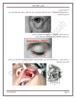 ‫الوجه‬ ‫عظام‬ ‫كسور‬
Dr. firas Kassab Page 71
**‫حُـَحك٤ش‬ َ‫حُٔيحه‬
-‫حُِٔظلٔش‬ َ‫ػز‬Transconjunctival:‫ػوذ‬ ‫ُظـ٘ذ‬ ‫ػخُ٤ش‬ ‫ٜٓخٍس‬ ‫طظطِذ‬ ٝ ‫ىه٤وش‬ ‫ِٓ٤ش‬ ٢ٛ ٝ ٖ‫حُـل‬ َ‫ٗط‬ ‫رؼِٔ٤ش‬ ‫أ٣٠خ‬ ٠‫طيػ‬
‫حُِٔظلٔش‬ ٝ‫أ‬ ٖ‫حُـل‬ ‫ؿِي‬
-٢ِ‫حُٔل‬ ٖ‫حُـل‬ َ‫ػز‬Subciliary:ٖ‫حُـل‬ ٢ُ‫طي‬ ‫حُؼِٔ٤ش‬ ٌٙٛ ‫اهظ٬١خص‬ ٖٓ
-‫حُلـخؽ‬ ‫طلض‬Subtarsal:‫اٗظ٘خٍح‬ َ‫ح٧ًؼ‬ ٝ ‫أٓخٗخ‬ َ‫ح٧ًؼ‬ ‫حُؼِٔ٤ش‬ ٢ٛ ٝ
-: ٢ٌ‫حُل‬ ‫حُـ٤ذ‬ َ‫ػز‬ٝ ١‫ؿِي‬ ‫ٗن‬ ٠ُ‫ا‬ ‫حُؼِٔ٤ش‬ ٌٙٛ ‫طلظخؽ‬ ٫ ٝ َ‫ح٧ٓل‬ ّ ‫حُلـخؽ‬ ‫هخع‬ ‫ٗظخ٣خ‬ ْ‫ىػ‬ ٠ُ‫ا‬ ‫حُؼِٔ٤ش‬ ٌٙٛ ‫طٜيف‬
١ٞٔ‫ك‬ َ‫ىحه‬ ‫ر٘ن‬ ٢‫ٌٗظل‬
 